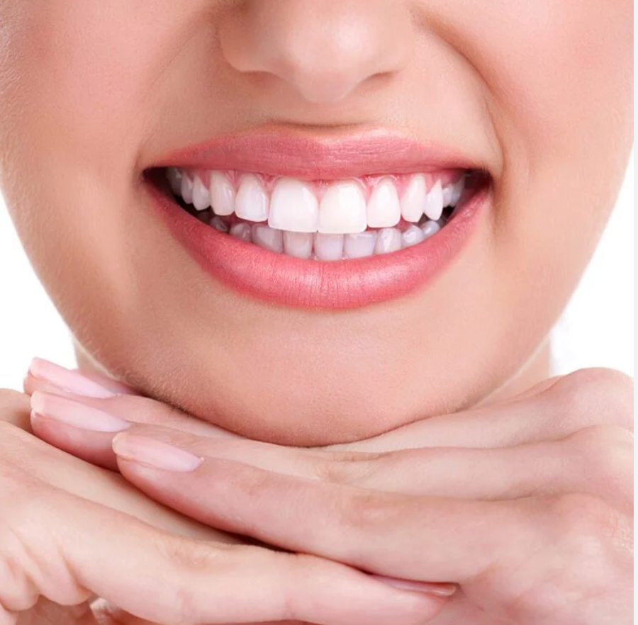 Smile design