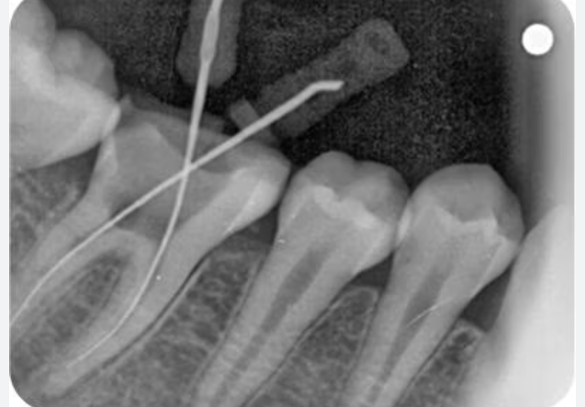 X-Ray RVG